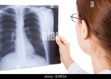 Female doctor examining a thorax x ray Stock Photo