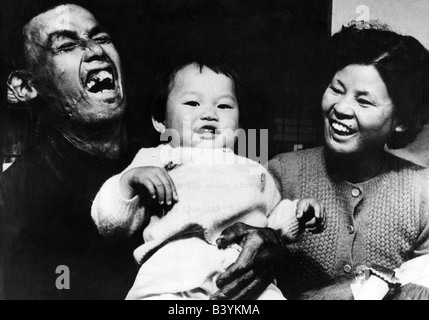 geography / travel, Japan, cities, Hiroshima, people, victims of atomic bomb, 1950s, Stock Photo
