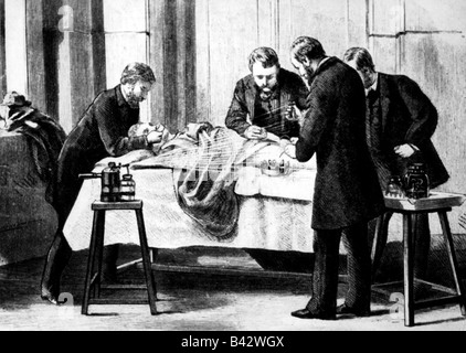 Lister, Joseph, 5.4.1827 - 10.2.1912, English surgeon, doing a surgery, woodcut, 1882, , Stock Photo