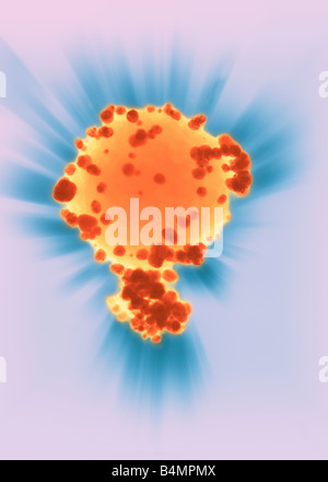 Conceptual image of the treatment of cancer cells being attacked by gold nanoparticles. Medical Applications of Nanotecnology Stock Photo