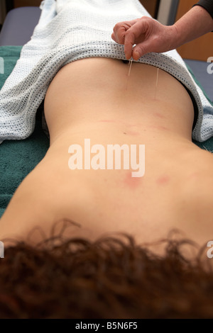 female acupuncturist applying acupuncture needles to the lower back of an adult woman late twenties to relieve back pain Stock Photo