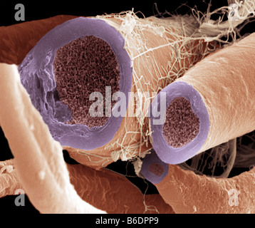Myelinated nerve fibres, coloured scanningelectron micrograph (SEM)