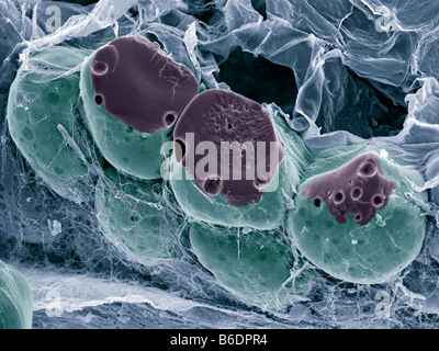 Fat (adipose) tissue,coloured scanning electron micrograph Stock Photo