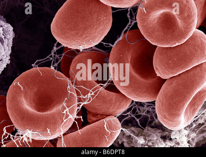 Blood clot, coloured scanning electron micrograph (SEM). Red blood cells are red and fibrin proteinstrands are green Stock Photo