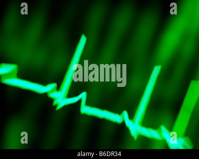 ECG trace. Computer artwork of an ECG (electrocardiogram) trace from a ...