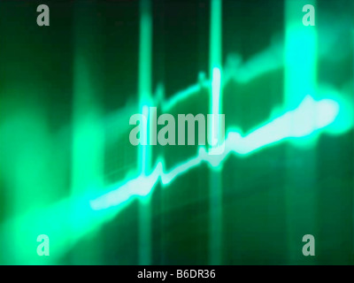 ECG trace. Computer artwork of an ECG (electrocardiogram) trace from a ...