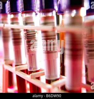Row of blood sample tubes in petri dishes, on white background Stock ...