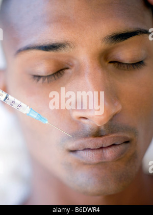 Botox treatment. Patient having botox injected into his upper lip. Botox is a neurotoxin used for cosmetic purposes. Stock Photo