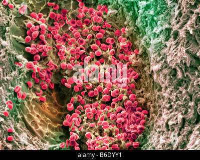 Blood clot, Coloured scanning electron micrograph (SEM) of blood clotting in an ovarian follicle. Stock Photo