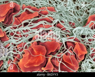 Blood clot, Coloured scanning electron micrograph (SEM) of blood clotting in an ovarian follicle. Stock Photo