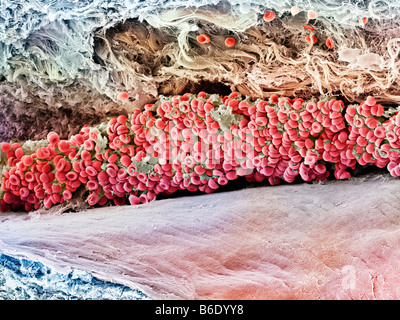 Blood clot, Coloured scanning electron micrograph (SEM) of blood clotting in an ovarian follicle. Stock Photo