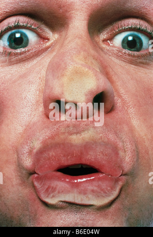 Man squashed face Stock Photo