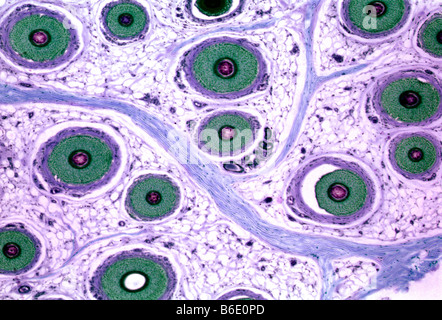 Skin. Light micrograph of a section through a human fingertip showing ...