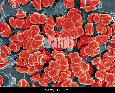 Blood clot. Coloured scanning electron micrograph (SEM) of red blood cells clumped together with fibrin to form a blood clot. Stock Photo