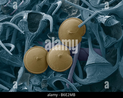 Prorocentrum dinoflagellates (blue),coloured scanning electron micrograph (SEM).Dinoflagellates are unicellular protozoans. Stock Photo