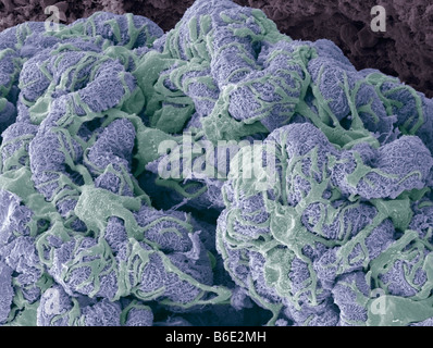 Kidney glomerulus. Coloured scanning electronmicrograph (SEM) showing the surface of aglomerulus. Stock Photo