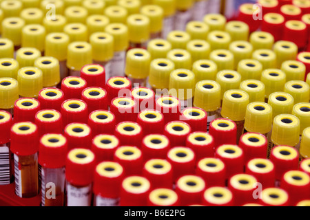 Blood samples. Barcoded vacutainer tubes containing blood samples. Stock Photo