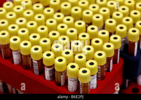 Blood samples. Barcoded vacutainer tubes containing blood samples. Stock Photo