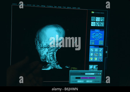 Egypt, CT scan of Tutankhamun Stock Photo - Alamy