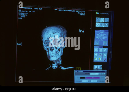 Egypt, CT scan of Tutankhamun Stock Photo - Alamy