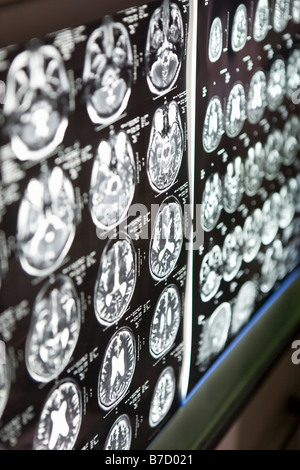 Brain scans on a light box Stock Photo