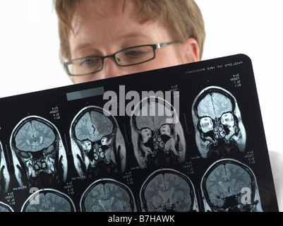 FEMALE DOCTOR WITH MRI SCAN OF BRAIN Stock Photo