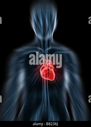 inflamed heart Stock Photo