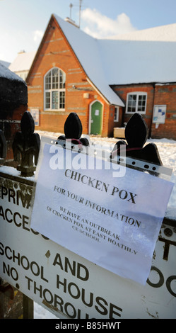 A sign on school gates warning parents of a chicken pox outbreak at the village primary school of East Hoathly, East Sussex, UK. Stock Photo