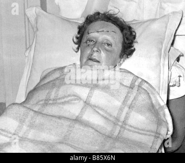 Piaf at the Rambouillet hospital after her car accident, September 7, 1958 Stock Photo