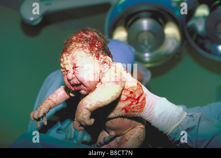 FV0456, Trevor Bonderud; New born infant being held by nurse Stock Photo