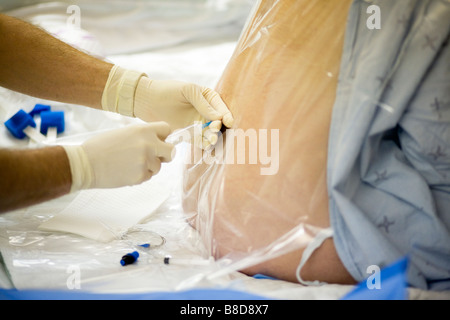 Pregnant Woman Receiving an Epidural Stock Photo