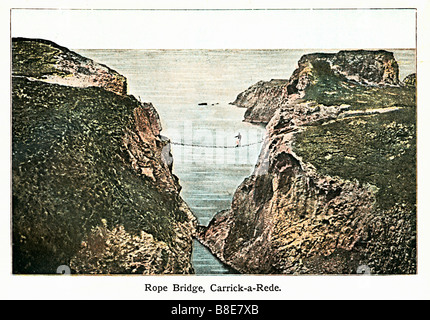 Rope Bridge Carrick a Rede Edwardian coloured photo of the suspension bridge on the Ulster coast Stock Photo