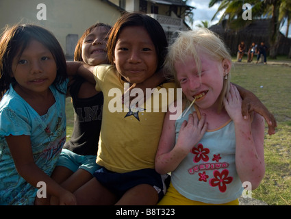 Albino children are known among the Kuna Indians as 'children of the moon.' Stock Photo