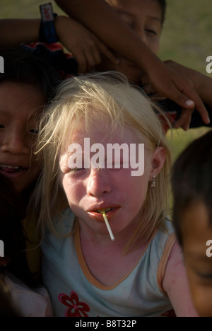 Albino children are known among the Kuna Indians as 'children of the moon.' Stock Photo