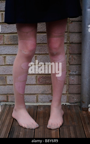 Young Girl wearing Torn Tights Stock Photo