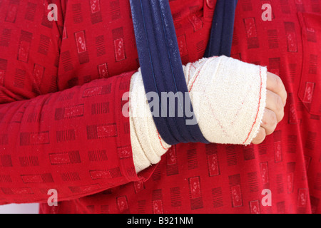 Bandaged arm Stock Photo
