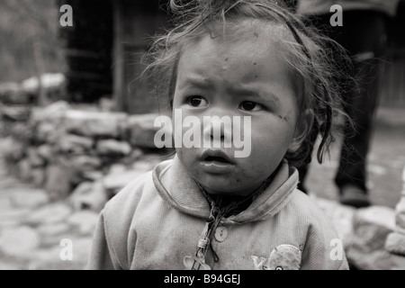 Annapurna Nepal 20 March 2008 Poor and dirty little girl in village on the trekker s trail Stock Photo