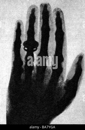 Roentgen, Wilhelm Conrad, 27.3.1845 - 10.2.1923, German physicist, first X-ray photo of his hand, 1895, Stock Photo