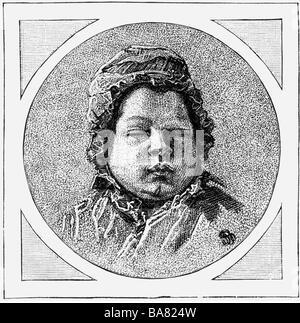 Napoleon Francois Joseph Charles, 20.3.1811 - 22.7.1832, King of Rome 1811 - 1814, Duke of Reichstadt 1817 - 1832, portrait, as child, wood engraving after drawing by Pierre Paul Prudhon, 1811, , Stock Photo