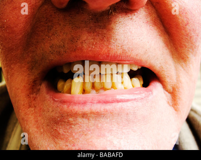Angry ugly man with crooked teeth and glasses isolated on white Stock ...