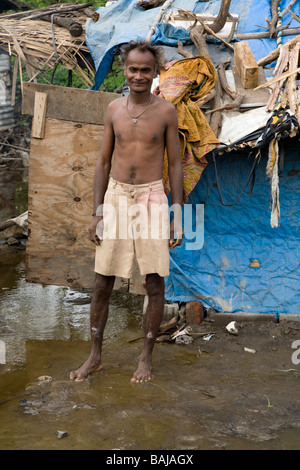 An inhabitant of a slum village in Hazira, Surat, Gujarat. India. Stock Photo