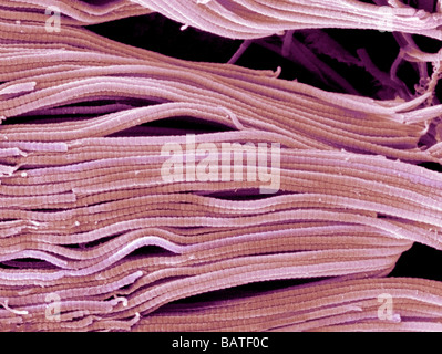 Collagen. Scanning electron micrograph (SEM) of collagen bundles from the delicate connectivetissue endoneurium. Stock Photo
