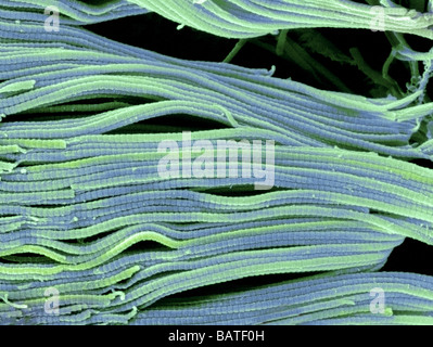 Collagen. Scanning electron micrograph (SEM) of collagen bundles from the delicate connectivetissue endoneurium. Stock Photo