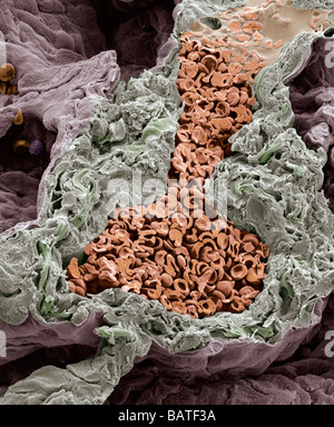 Blood vessel in the lung, coloured scanning electron micrograph.This small artery is fractured to show enclosed red bloodcells Stock Photo