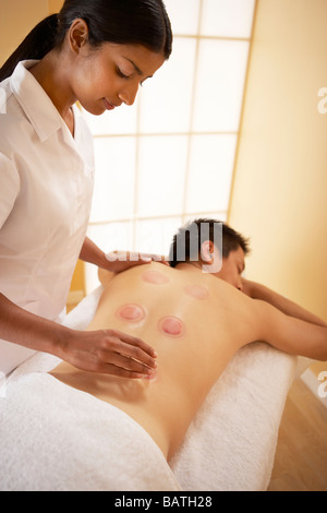 Cupping. Therapist removing heated cups from her client's back.Cupping, or fire cupping is derived from chinese medicine. Stock Photo