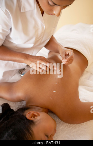 Acupuncture. Acupuncturist inserting a needle into a client's back. Stock Photo