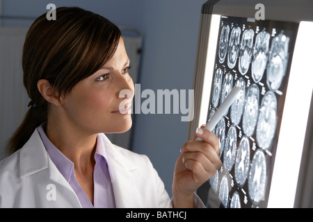 Doctor examining MRI scans.The scans are sagittal (side view) sections through a patient head Stock Photo