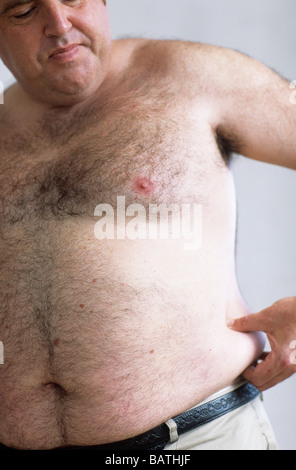 Obesity. 39-year-old overweight man pinching the fat on his waist. Stock Photo