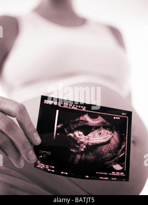 Ultrasound scan. Pregnant woman holding anultrasound scan of her foetus in front of herswollen abdomen. Stock Photo