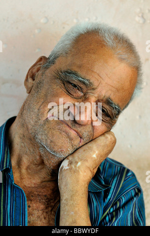 Leprosy patient, 78 years, with a crippled hand, sad smile, leprosy colony Agua de Dios, Colombia, South America Stock Photo